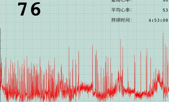 心率正常范围_心率_有氧心率和无氧心率的区别