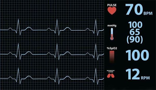 ppg心率和ecg心率_心率不齐怎么办最低心率42_心率